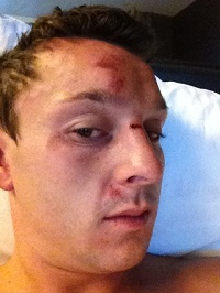 trickett hurt